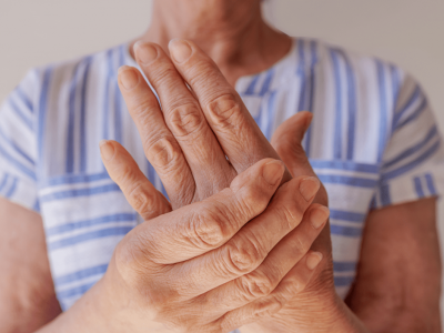 La artritis reumatoide y sus efectos en los ojos