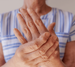 La artritis reumatoide y sus efectos en los ojos