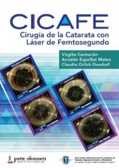 Cirug&iacute;a de la Catarata con L&aacute;ser de Femtosegundo