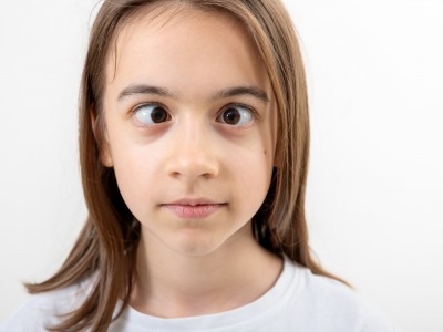 Strabismus: when the eyes do not look in the same direction