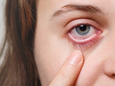 Habits that can worsen dry eyes