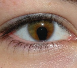 El coloboma, &iquest;qu&eacute; es?