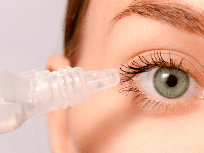 What is keratitis?